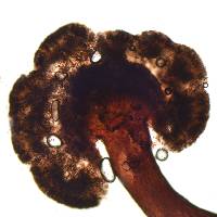 Mycocalicium victoriae image