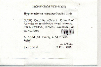Hypotrachyna sinuosa image