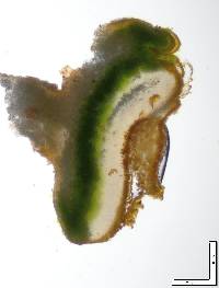 Squamulea squamosa image