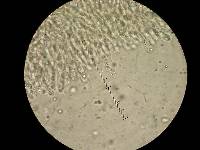 Lichenomphalia umbellifera image