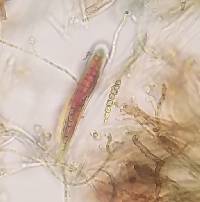 Bactrospora brevispora image