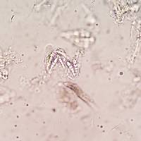 Coniocarpon rubrocinctum image