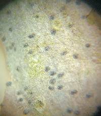 Arthonia glaucella image