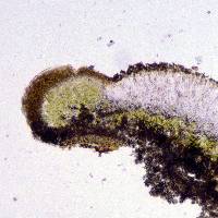 Protoparmeliopsis bipruinosa image