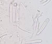 Bactrospora brodoi image