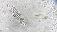 Bactrospora lamprospora image