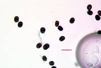 Calicium brachysporum image