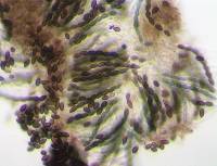 Mycocalicium subtile image