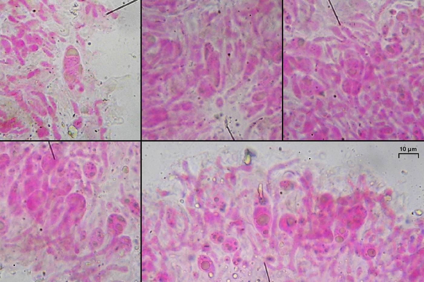 Tremella diploschistina image