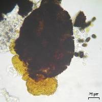 Lichenostigma triseptatum image