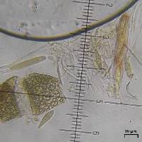 Cercidospora xanthoriae image